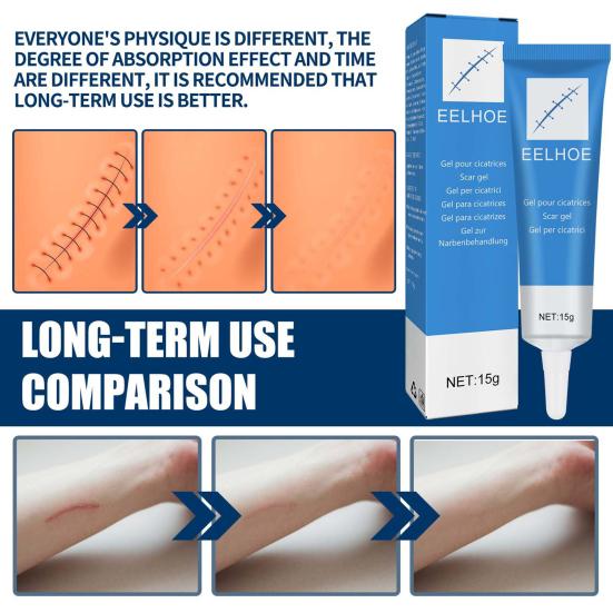 GEL ANTICICATRIZ EELHOE - 15G