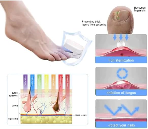 Láser para Uñas | Mejora la Apariencia de tus Uñas desde Casa