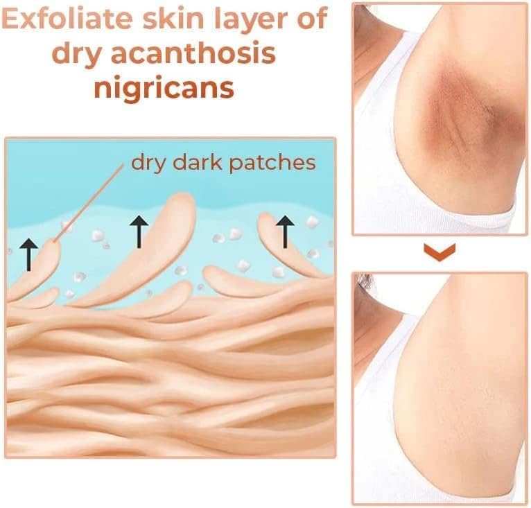 ACEITE ACLARANTE PARA ZONAS OSCURAS - INTIMO ACANTOSIS