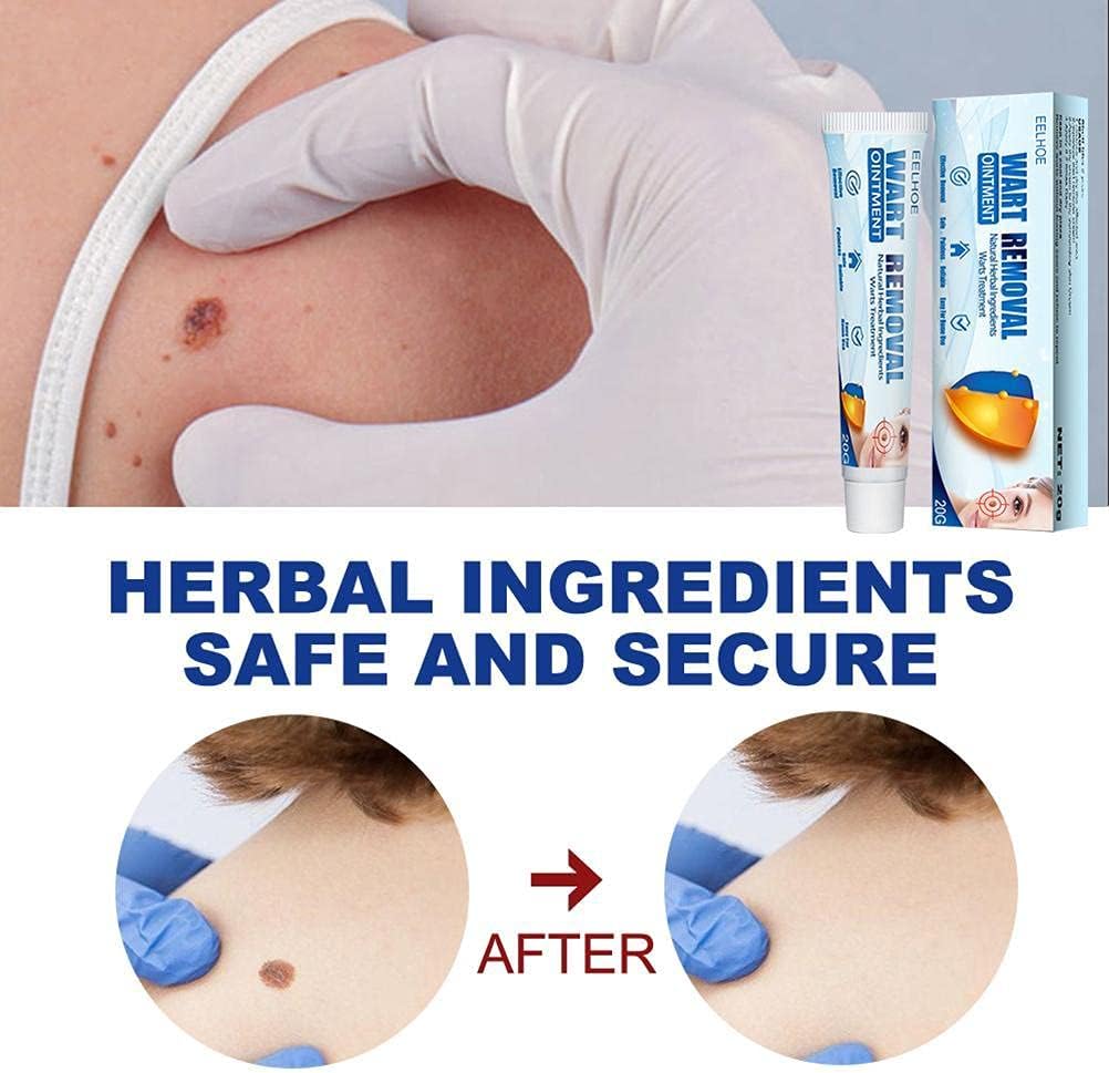 CREMA ELIMINA VERRUGAS Y LIMPIA PIEL 20G