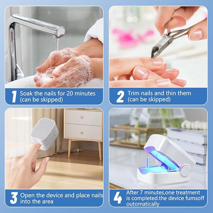 Láser para Uñas | Mejora la Apariencia de tus Uñas desde Casa