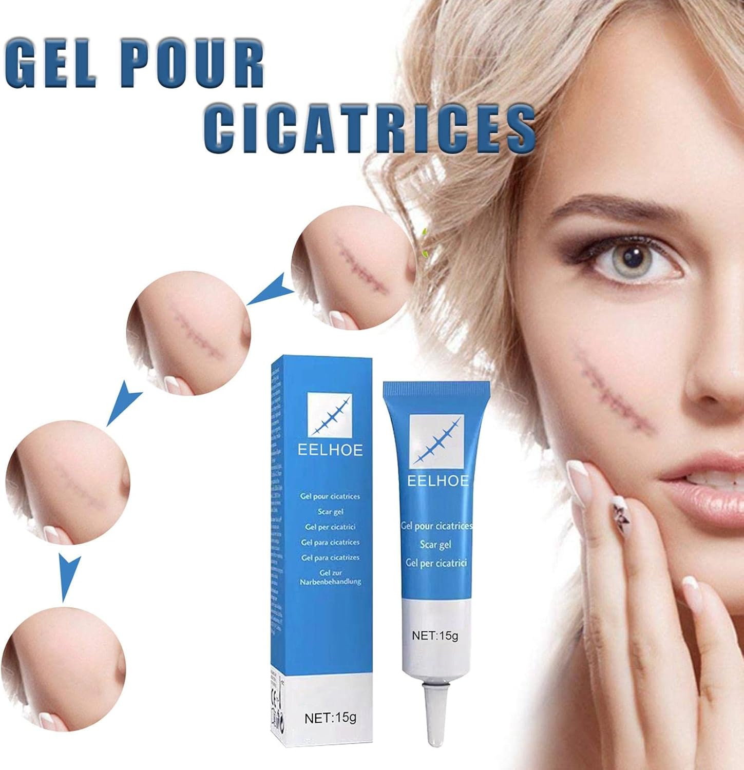 GEL ANTICICATRIZ EELHOE - 15G