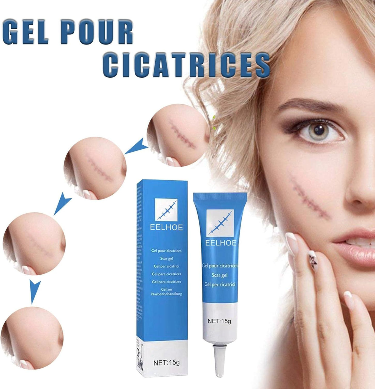GEL ANTICICATRIZ EELHOE - 15G