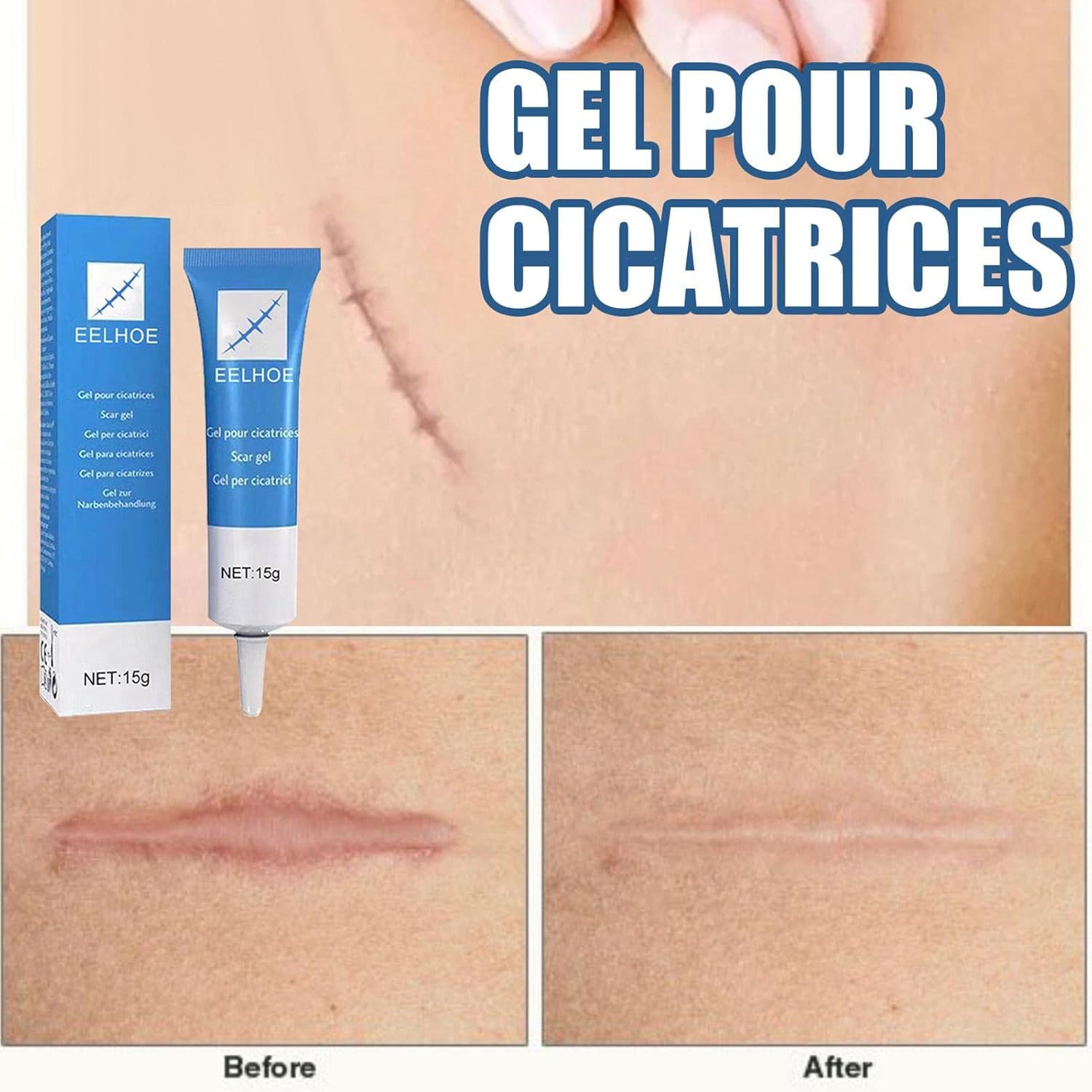 GEL ANTICICATRIZ EELHOE - 15G