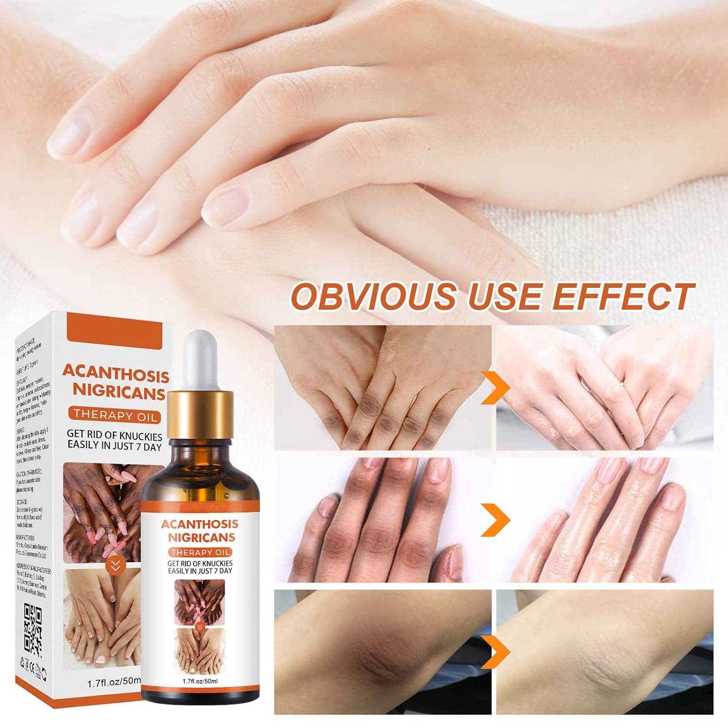 ACEITE ACLARANTE PARA ZONAS OSCURAS - INTIMO ACANTOSIS