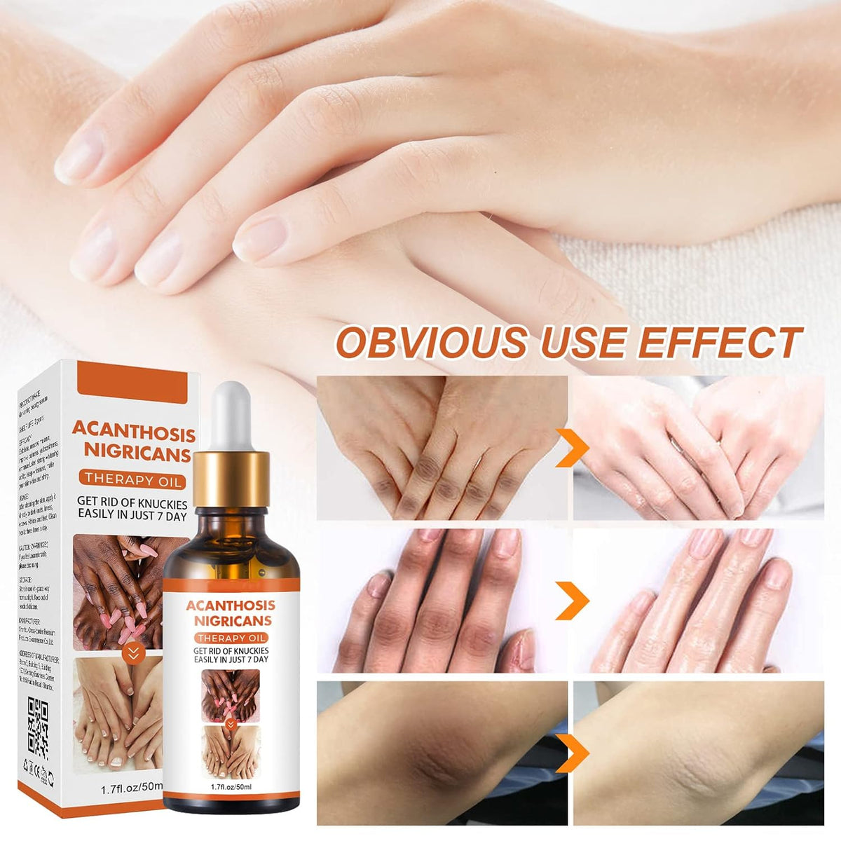 ACEITE ACLARANTE PARA ZONAS OSCURAS - INTIMO ACANTOSIS