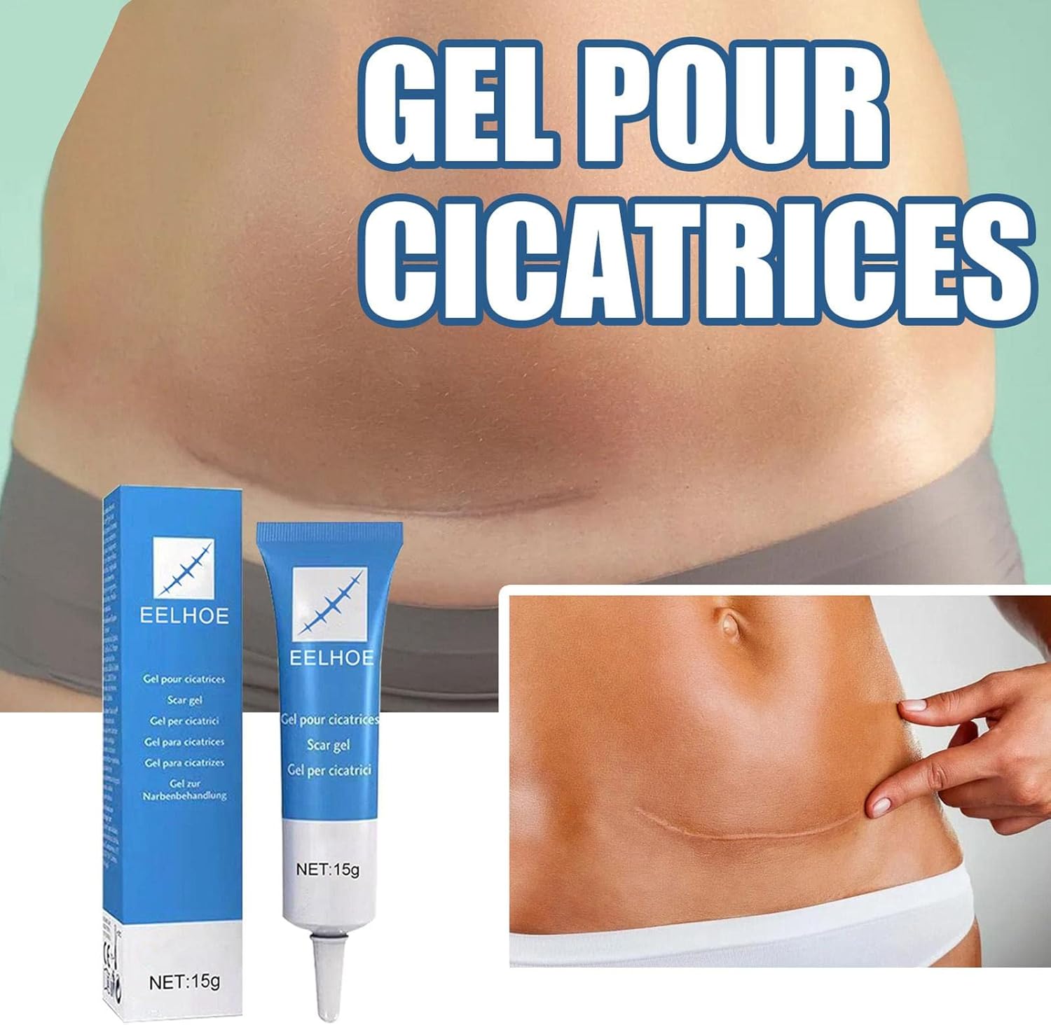 GEL ANTICICATRIZ EELHOE - 15G