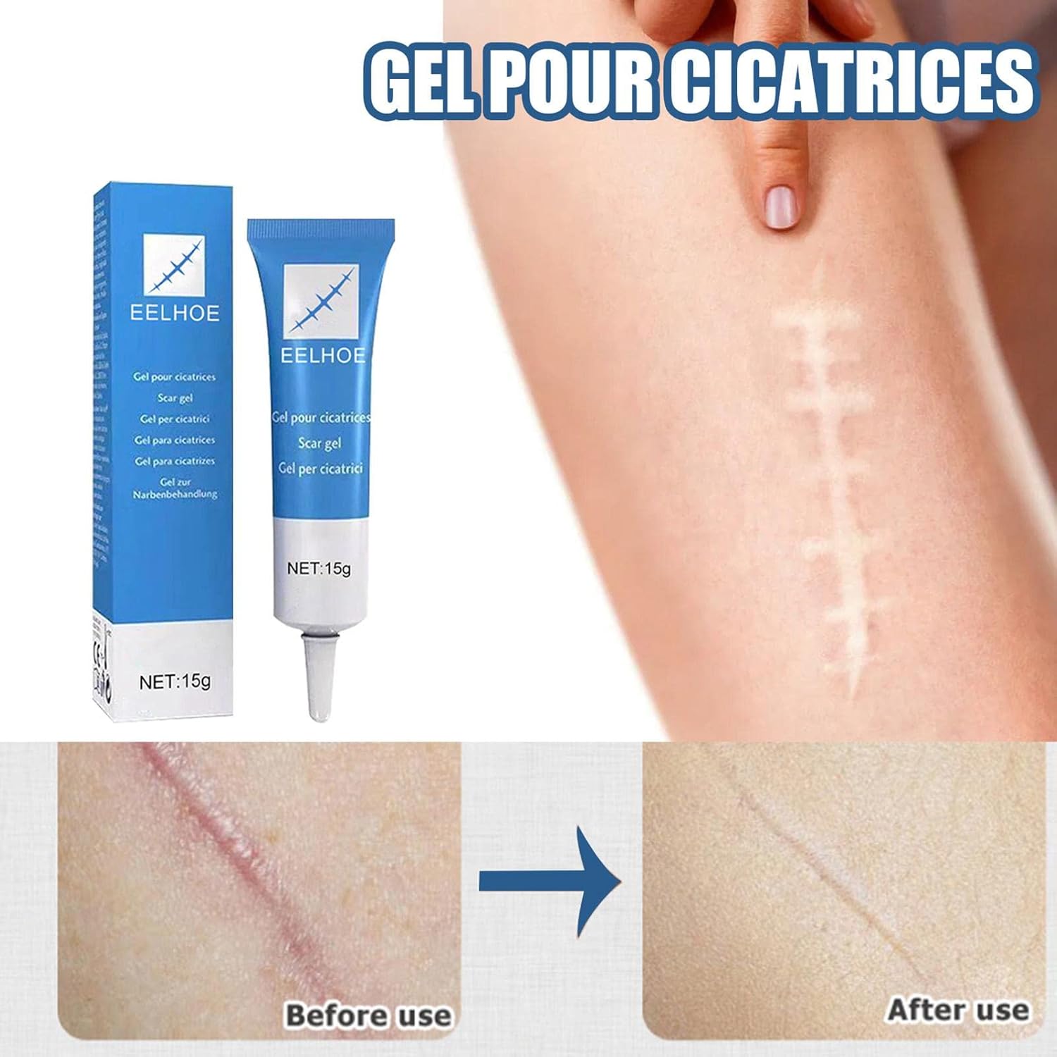 GEL ANTICICATRIZ EELHOE - 15G