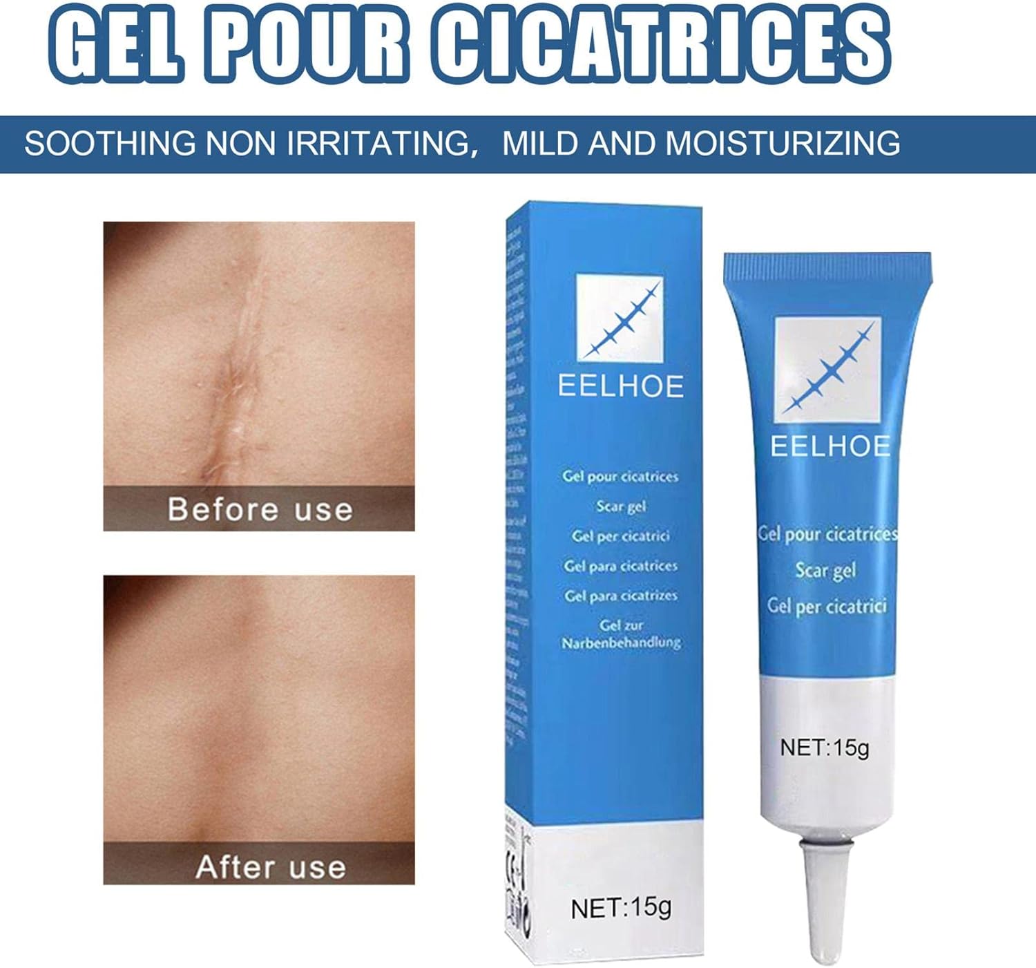 GEL ANTICICATRIZ EELHOE - 15G