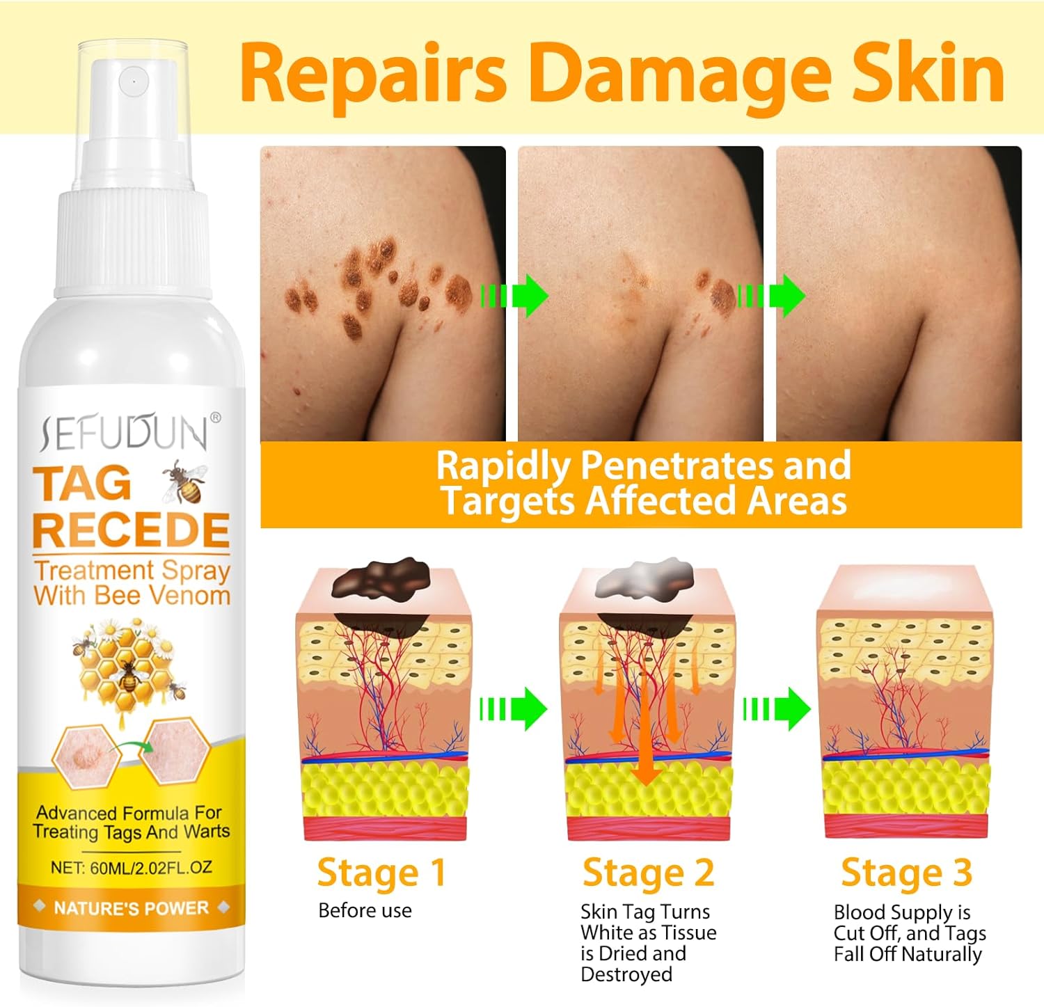 SPRAY BEE VENOM PARA ELIMINAR VERRUGAS