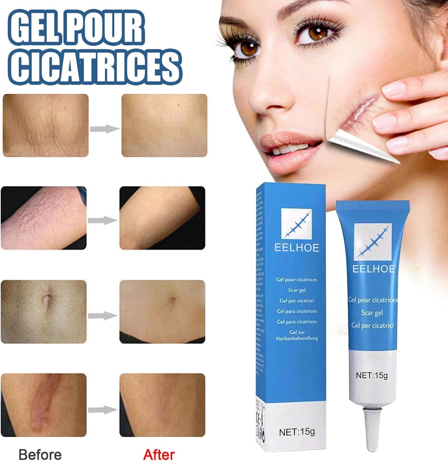 GEL ANTICICATRIZ EELHOE - 15G