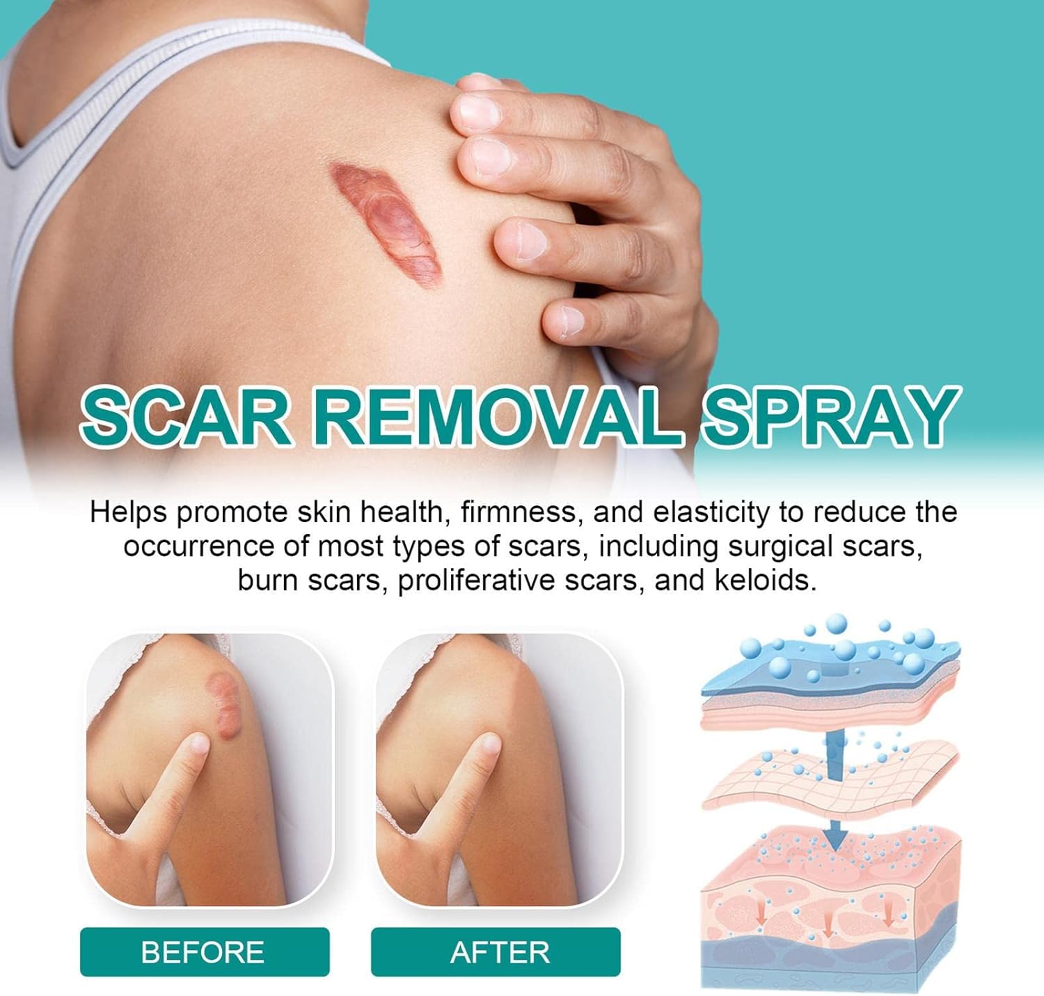 SPRAY PARA CICATRICES 20GR