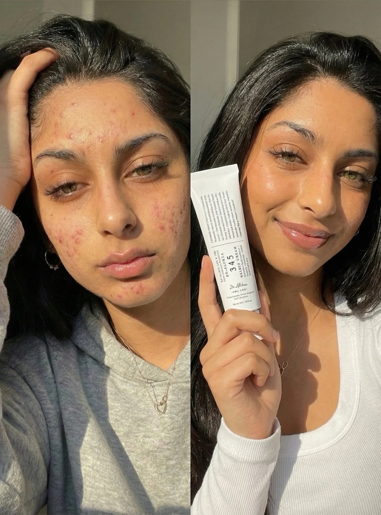 Crema Dr. Althea 345 Relief – Crema Coreana Calmante para Manchas, Hidratación y Piel Sensible