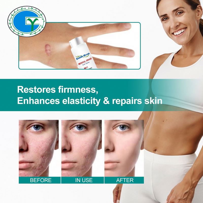 SPRAY PARA CICATRICES 20GR